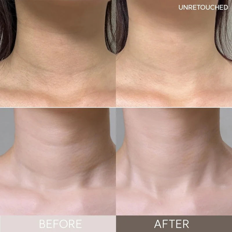 Wrinkle Repair Hydrogel Neck Patch
