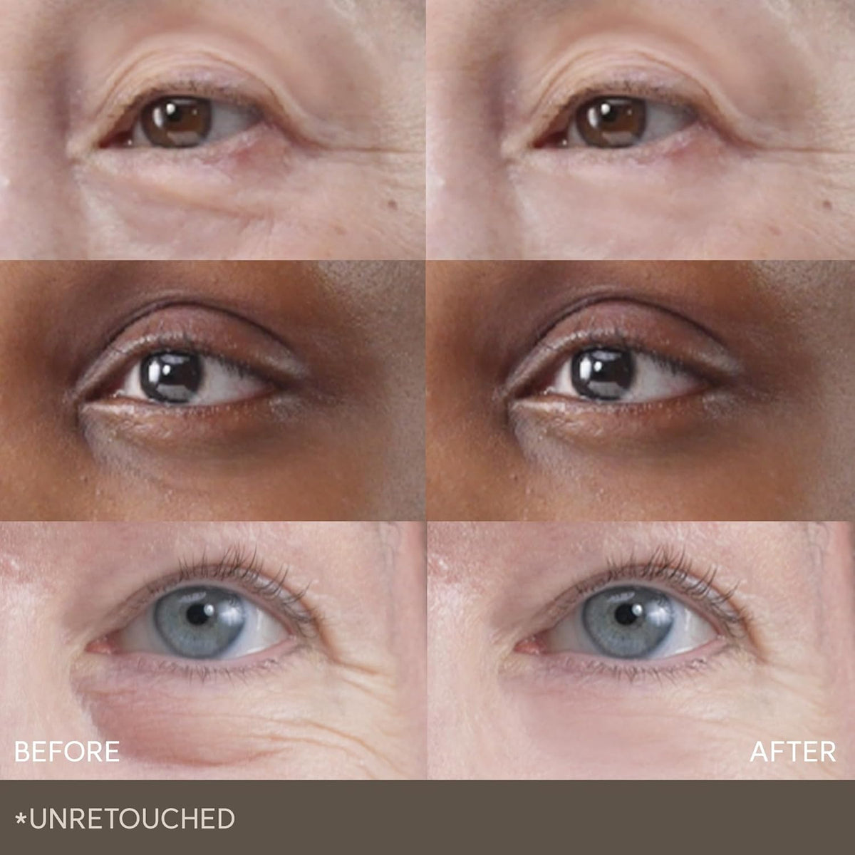 Wrinkle Repair Hydrogel Eye Patch