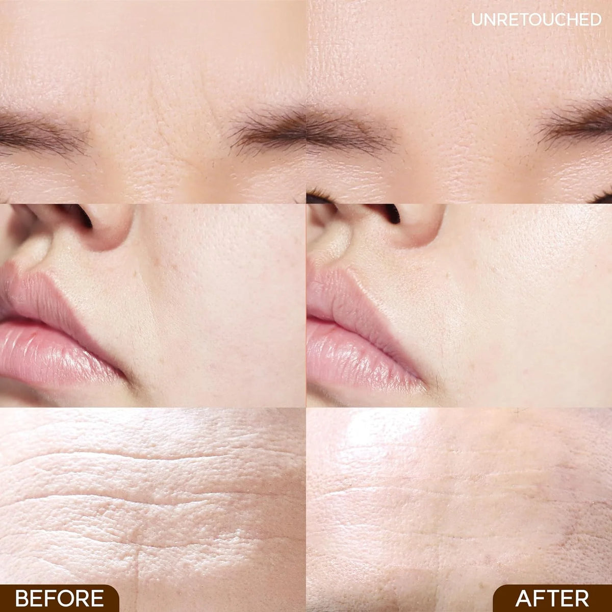 Wrinkle Repair Frown Line Patch